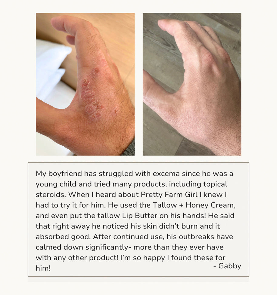 Fragrance Free Tallow + Honey Cream for Sensitive Skin