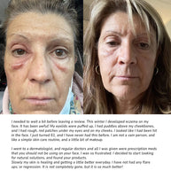 Pure + Simple Skin Kit for Sensitive Skin